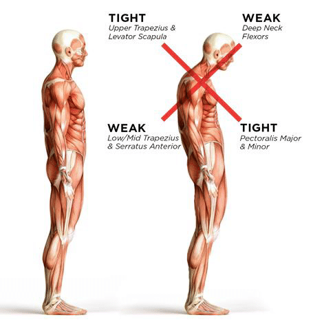 Shoulder - 3 Dimensional Physical Therapy