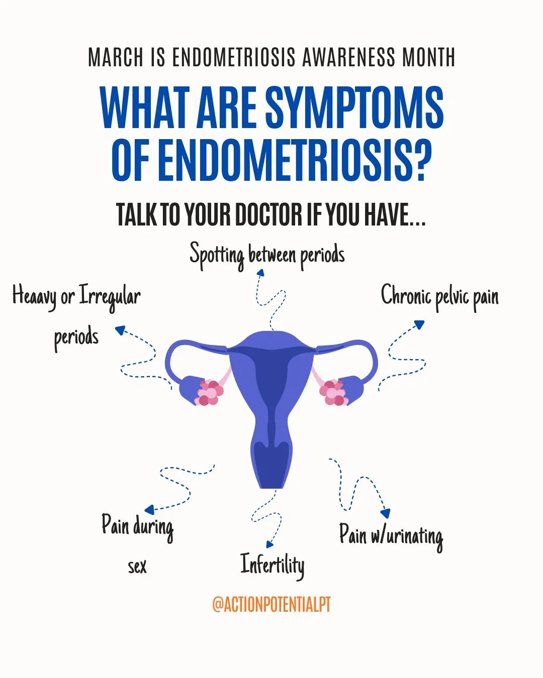 Symptoms of Endometriosis