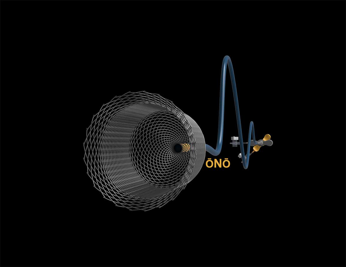 rendering of full ono device basket up front on black background
