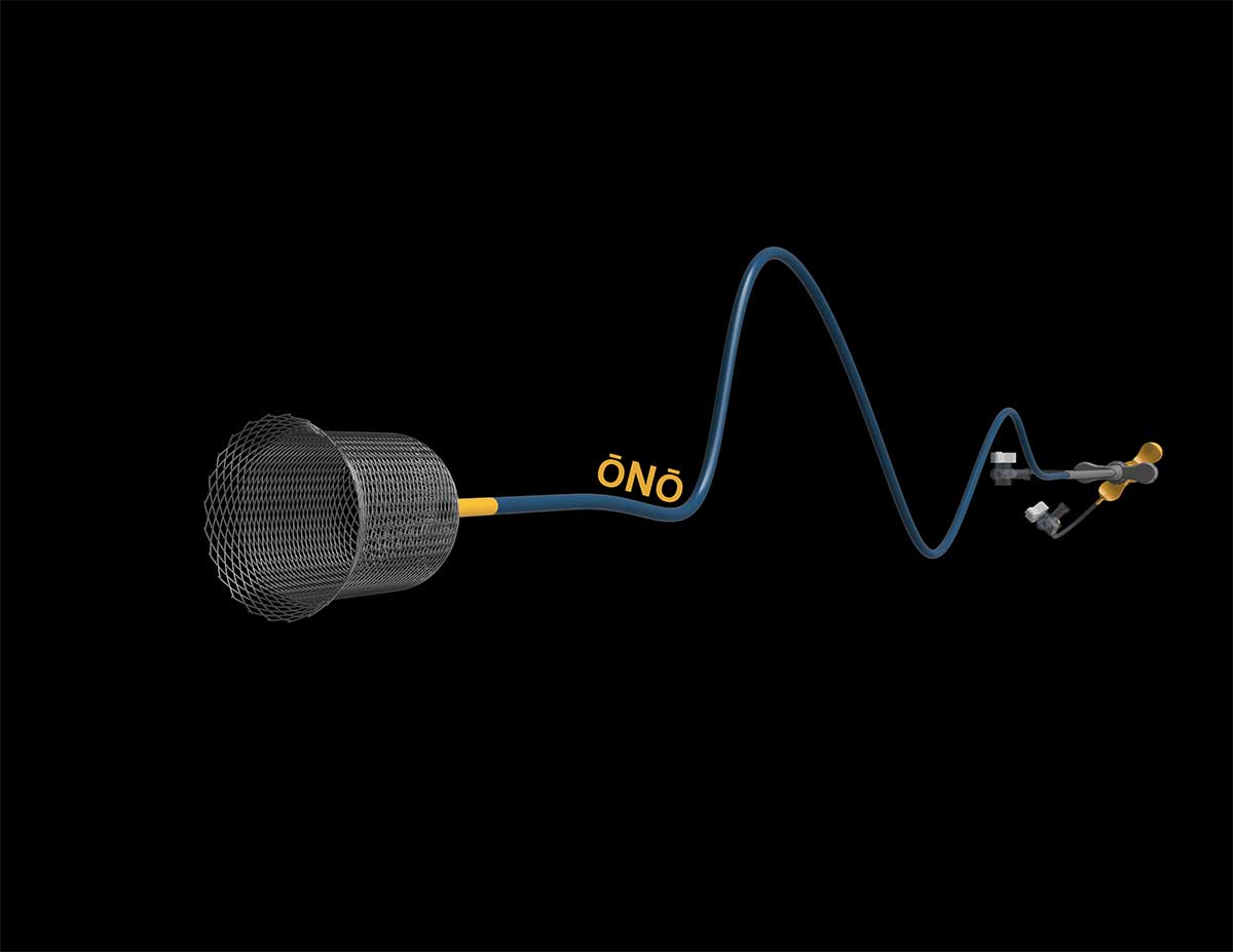 rendering of full ono device basket and controls on black background