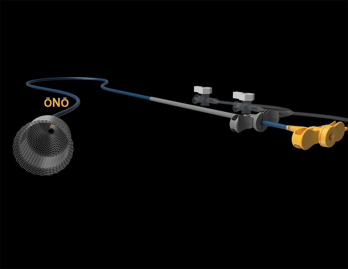 rendering of full ono device basket and controls on black background