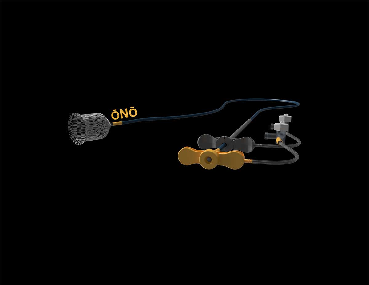 rendering of ono device basket and controls on black background