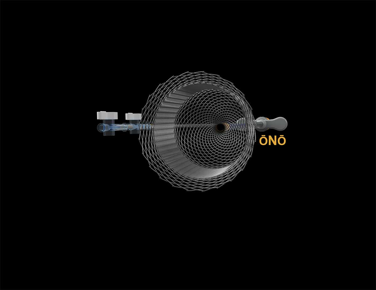 rendering of front of basket on black background